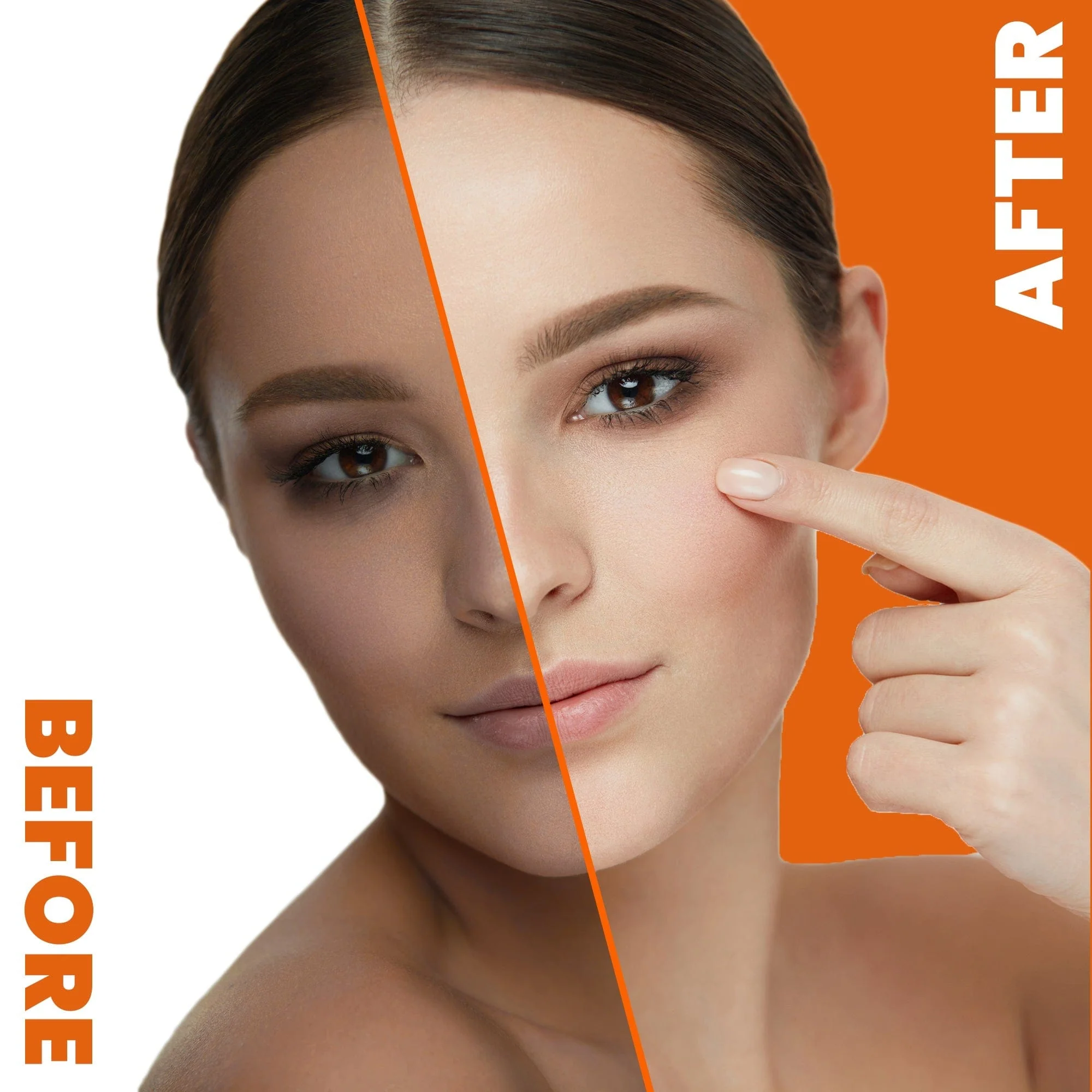 Neoprosone Brightening Gel With Vitamin C 30g / 1 fl oz - Image 4