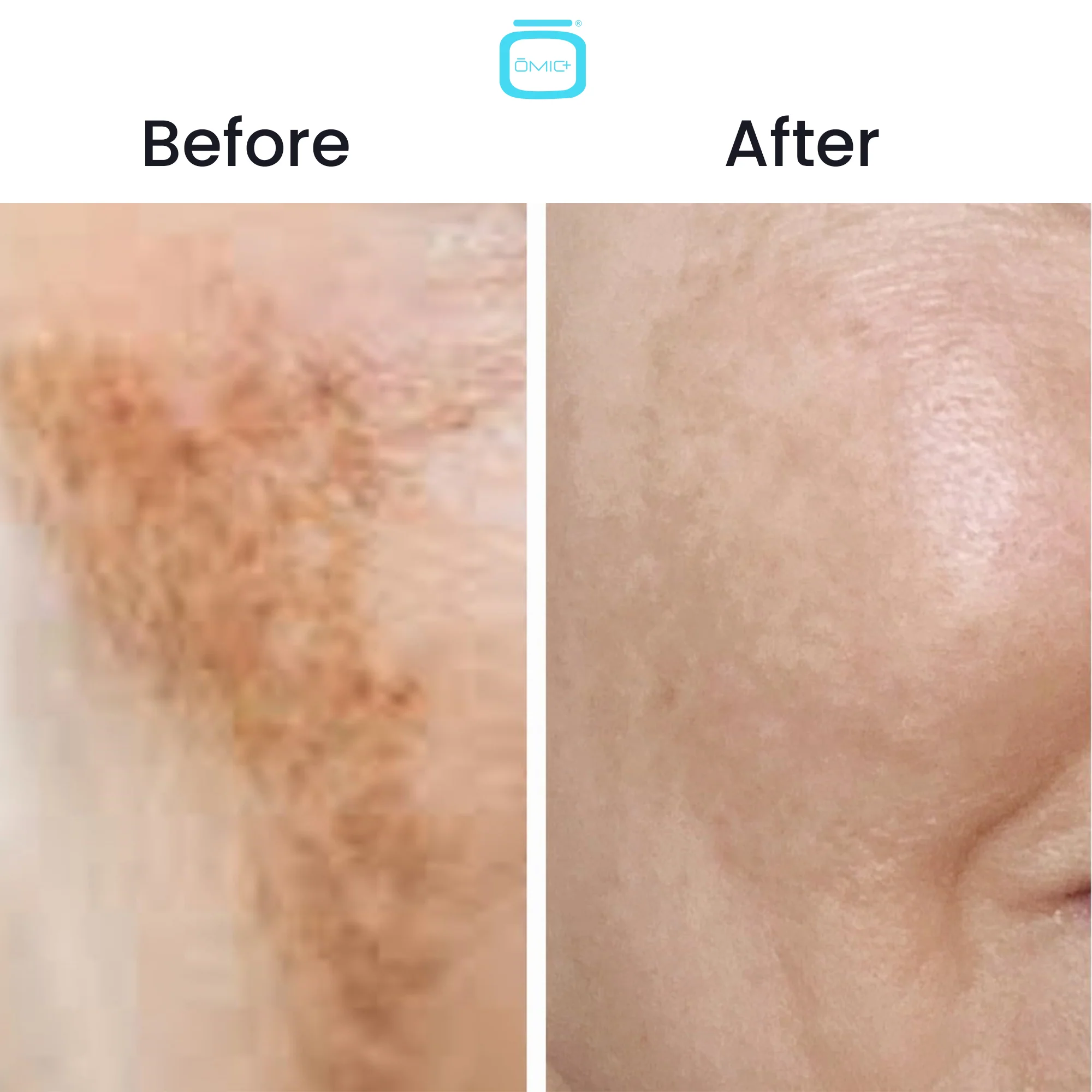 Omic+ 10% Tranexamic Acid Cream 30ml - Image 8