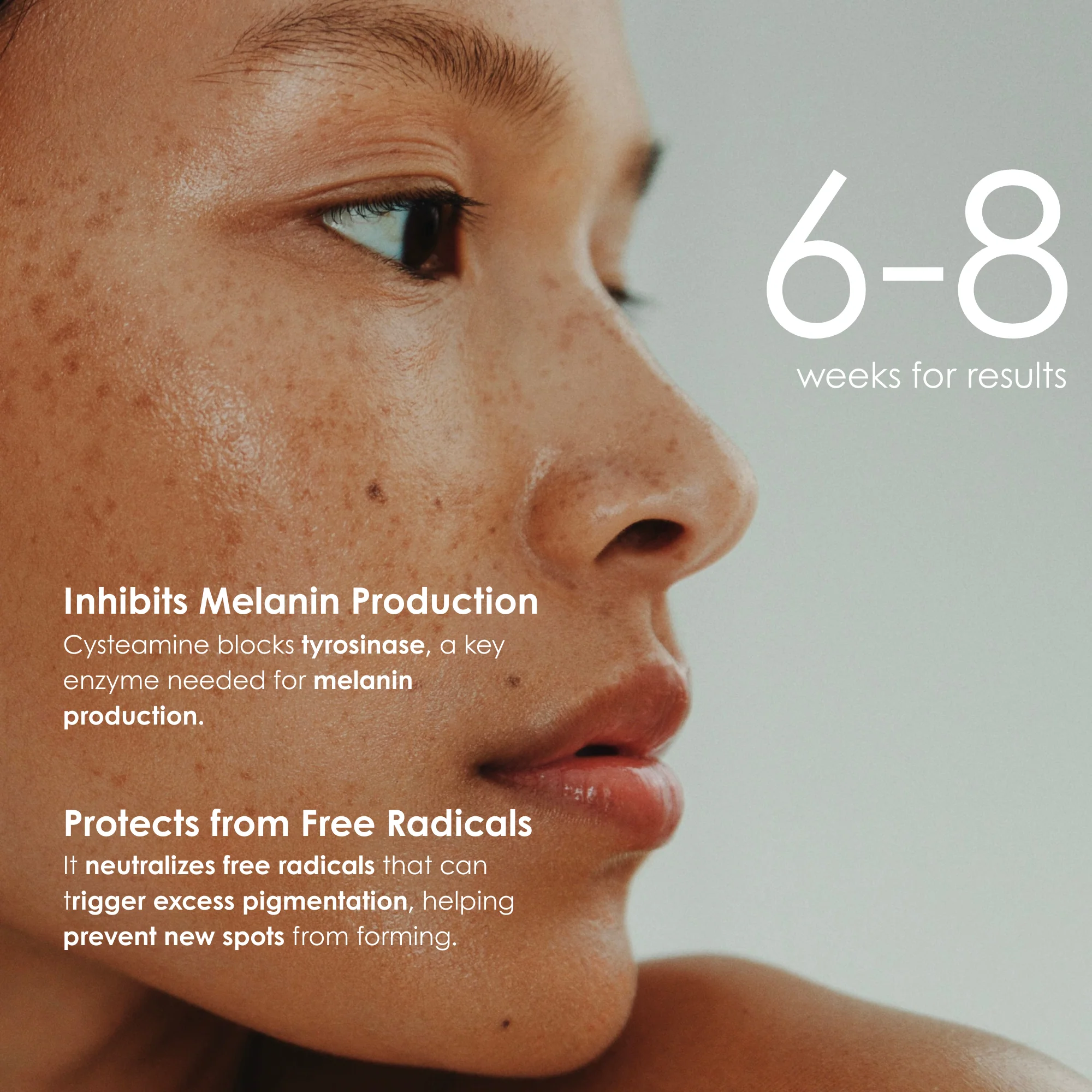 Omic+ 5% Cysteamine Intensive Corrector Serum - Image 3