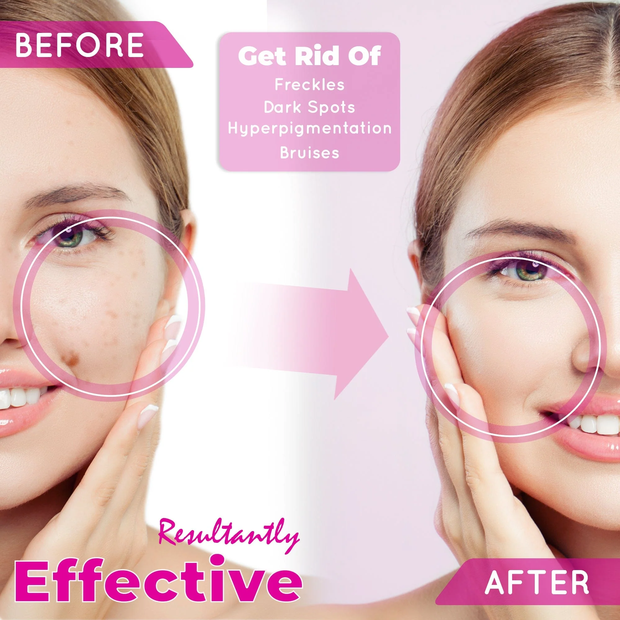 So White Skin Perfector Dark Spot Corrector Gel 30ml - Image 4